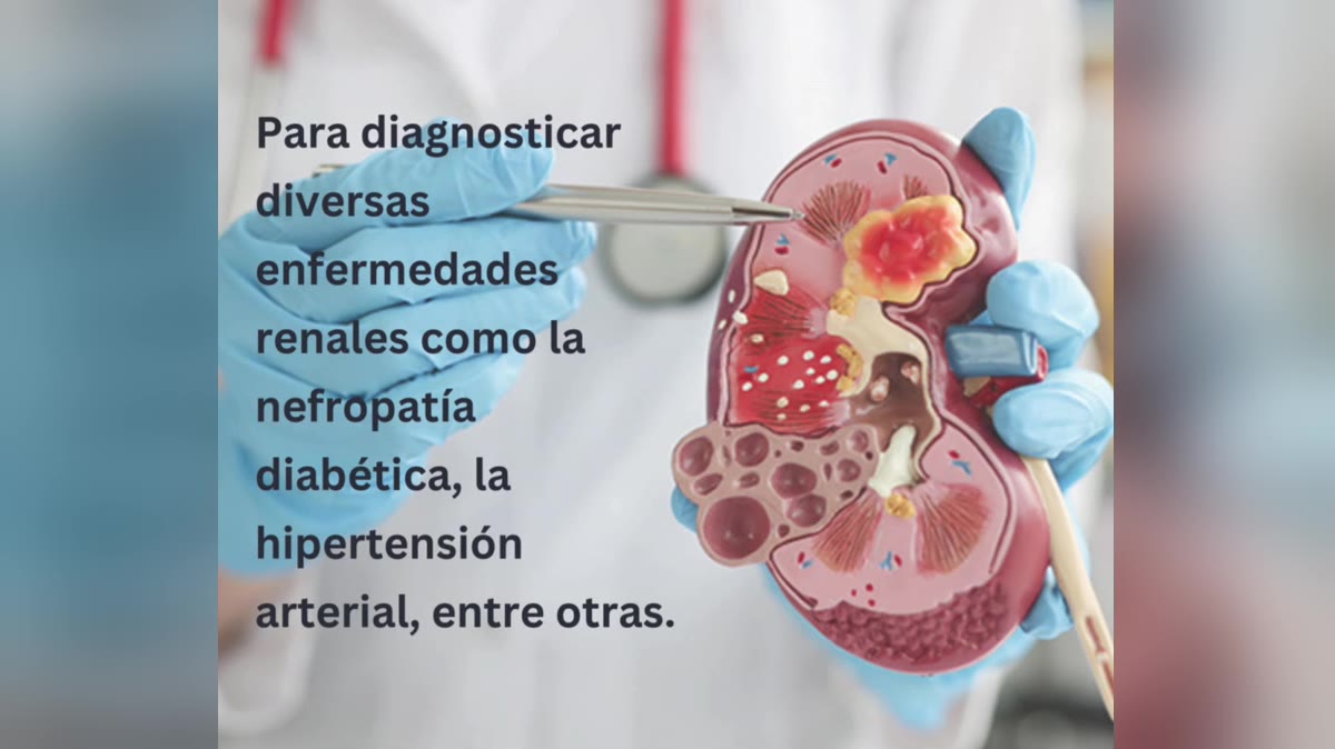 renograma-medicina-nuclear-portada.jpg